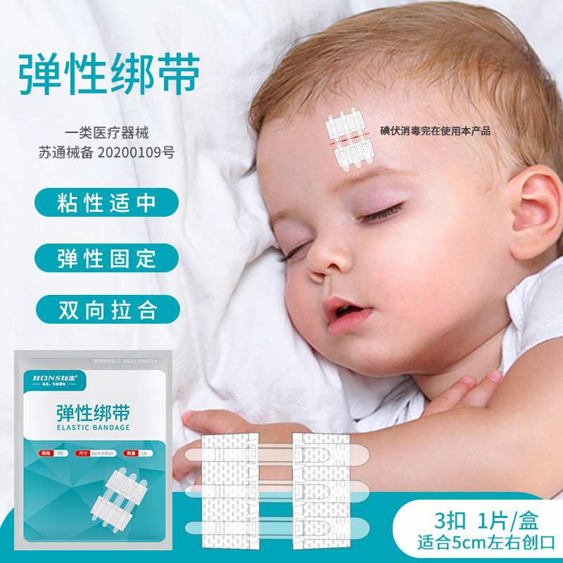 ホンシェン張力緩和器、縫合不要創傷閉鎖器、不織布ジッパー式創傷パッチ、皮膚張力緩和吻合器