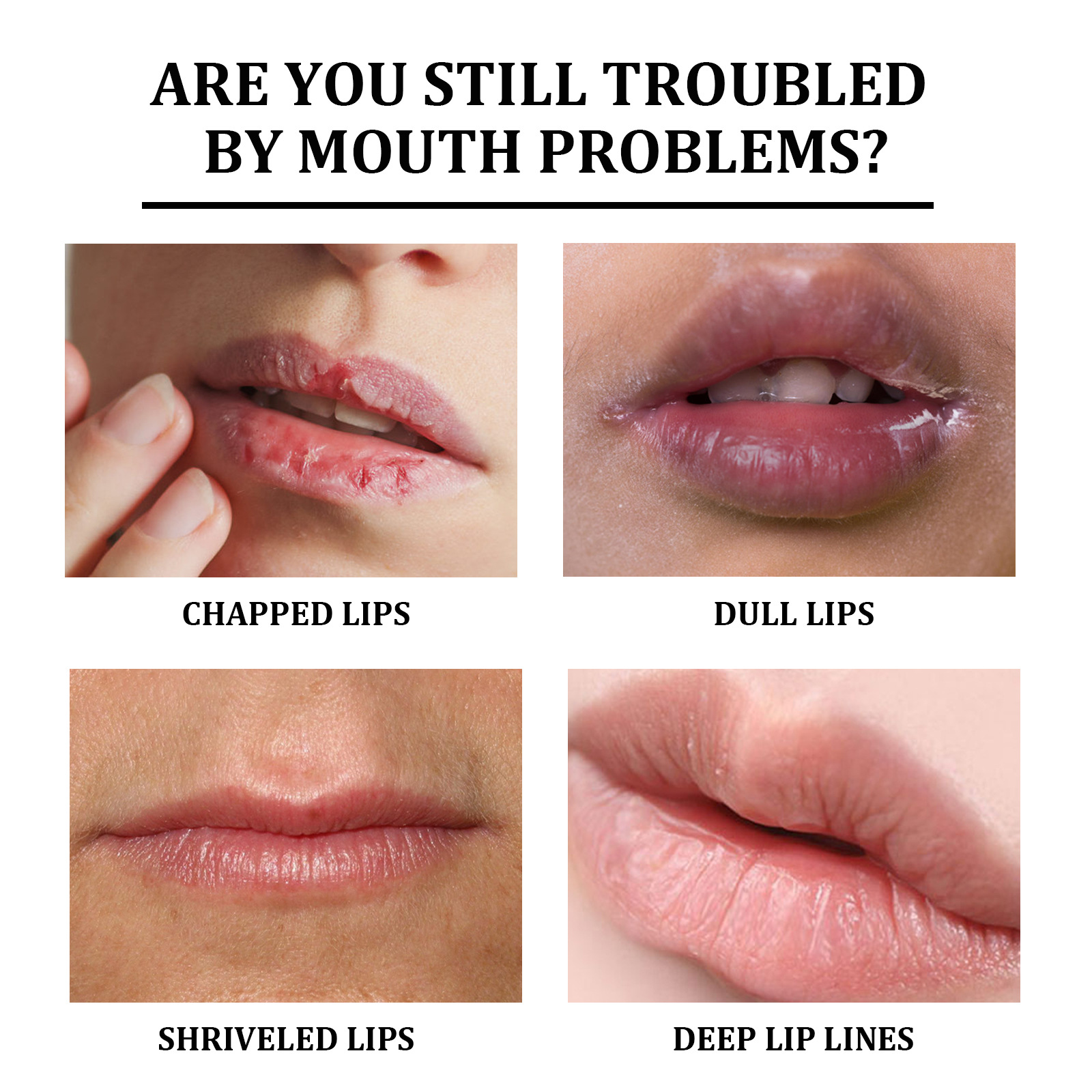 La Crema Labbra Lucidante riduce la melanina nelle rughe delle labbra, nella pelle morta, idrata le labbra e le labbra tenere 2024_voghion.com