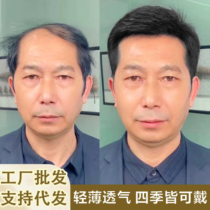 Wig for Men with Short Hair, Middle-Aged Men's Real Hair Headgear, Middle-Aged and Elderly Dads, Handsome and Realistic, Light and Thin Hairstyle, Real Hair