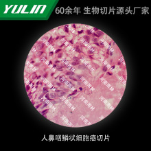 �˱����[�������Ƭ��У�t�WԺУ�ýM������ʯϞ��Ƭ�˱��@΢�R