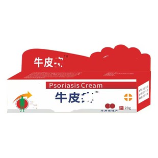A generation of skin ointment skin tinea king ointment genuine goods remove cowhide fresh sweat spots cowhide fresh ointment