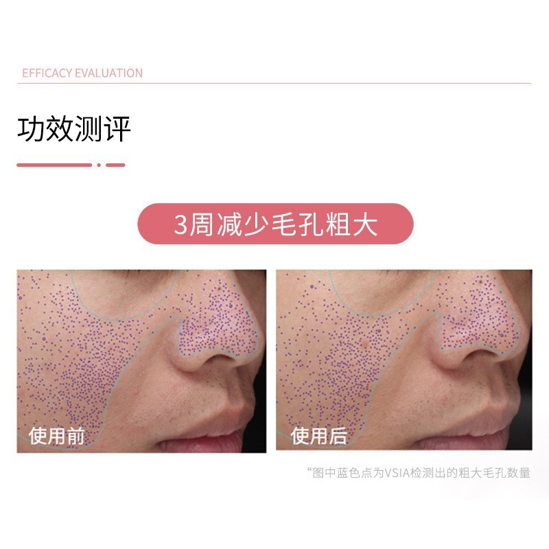 病院装着オリゴペプチドリペア 8万粒 アクティブフリーズドライパウダーセット 術後毛穴縮小・ニキビ除去・修復フリーズドライパウダーセット|undefined
