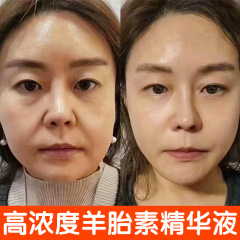 羊胎素精華液は細目を薄めてシワをしっかりと除去して水を補います。保湿は初老美容院の抗シワ精華液です。