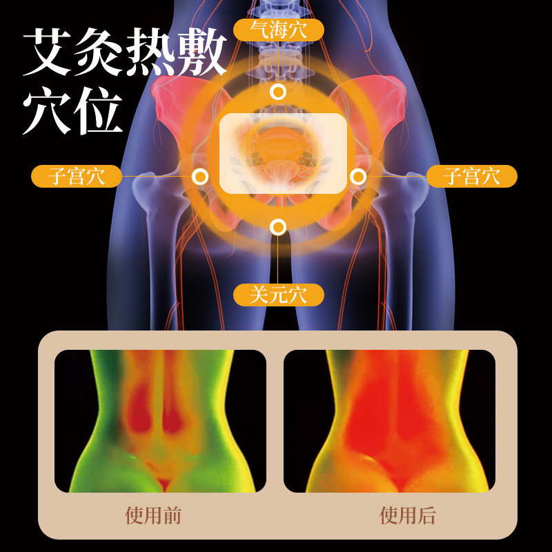 暖かい赤ちゃんは艾草を貼って熱を出します。灸を貼って宮を貼ります。|undefined
