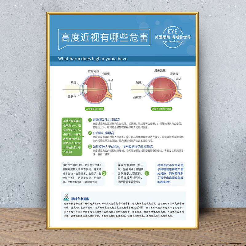 眼鏡店の壁面装飾画眼科病院は目の構造を描いています。|undefined