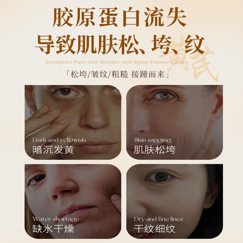 iOEO黄芪臻美抗皱御龄精华液 抗皱紧致淡纹细纹面部精华液批发|undefined