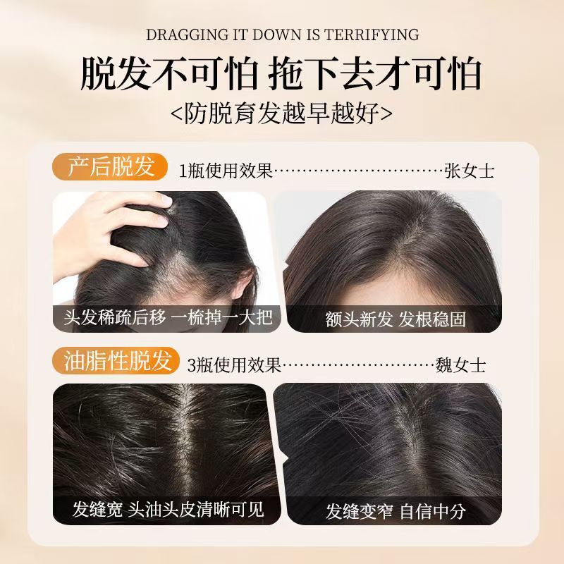 仁和药业生姜防脱洗发水发长发男女通用|undefined