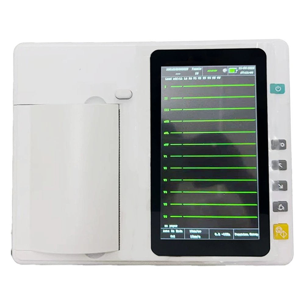 Цифровой электрокардиограф для трансграничной торговли, для получения скидок обращайтесь к службе поддержки клиентов, 12-канальный, автоматический анализ, оптовая продажа от производителя.