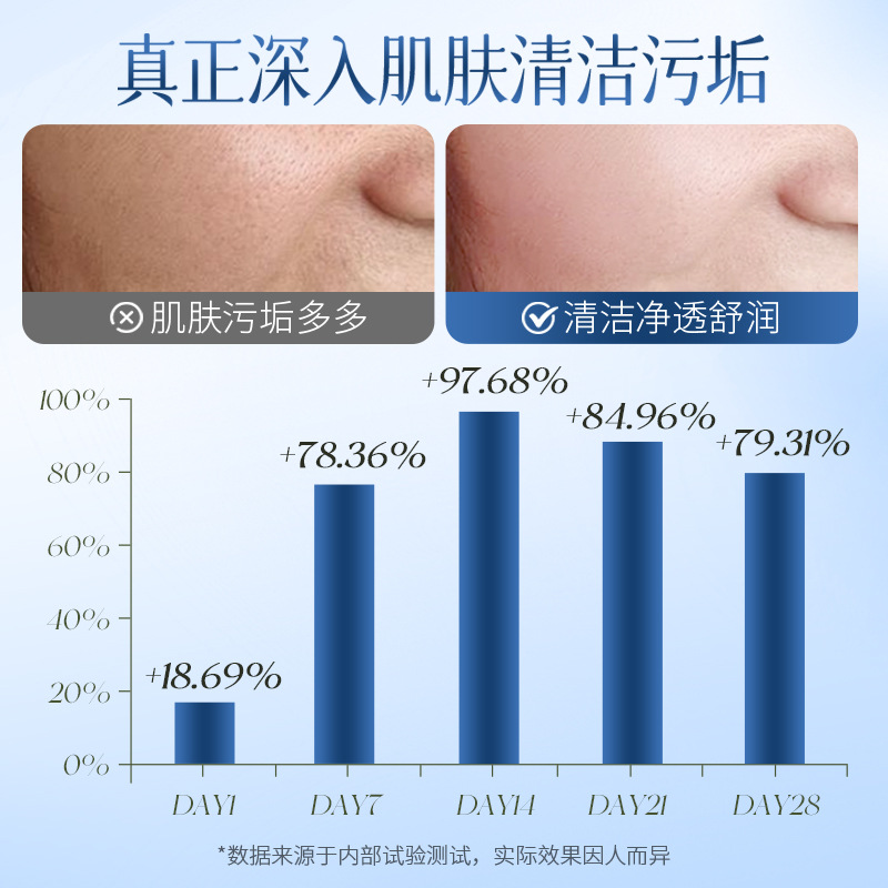 Bai Zhen Tang aminoácidos calmante limpiador facial espuma suave limpia hidratante no tensión limpiador facial al por mayor