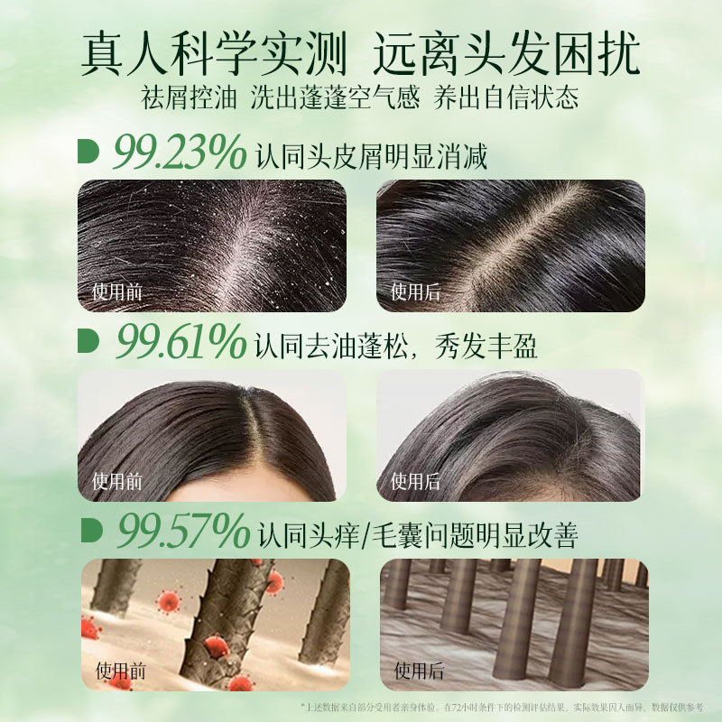 Star Window Sin aceite de silicona Té blanco Fragancia Champú de aminoácidos anticaspa Acondicionador ligero y esponjoso Mascarilla para el cabello