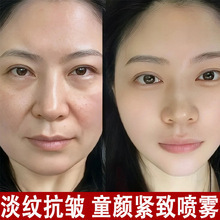 しわ取りスプレー、しわ防止美容液、保湿、保湿、リフティング、アンチエイジング、小じわの軽減、子顔Vフェイス引き締めスプレー|undefined