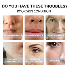 EELHOE 蛋白提升線補水淡化細紋皮膚盈潤抗皺提拉面部輪廓緊緻