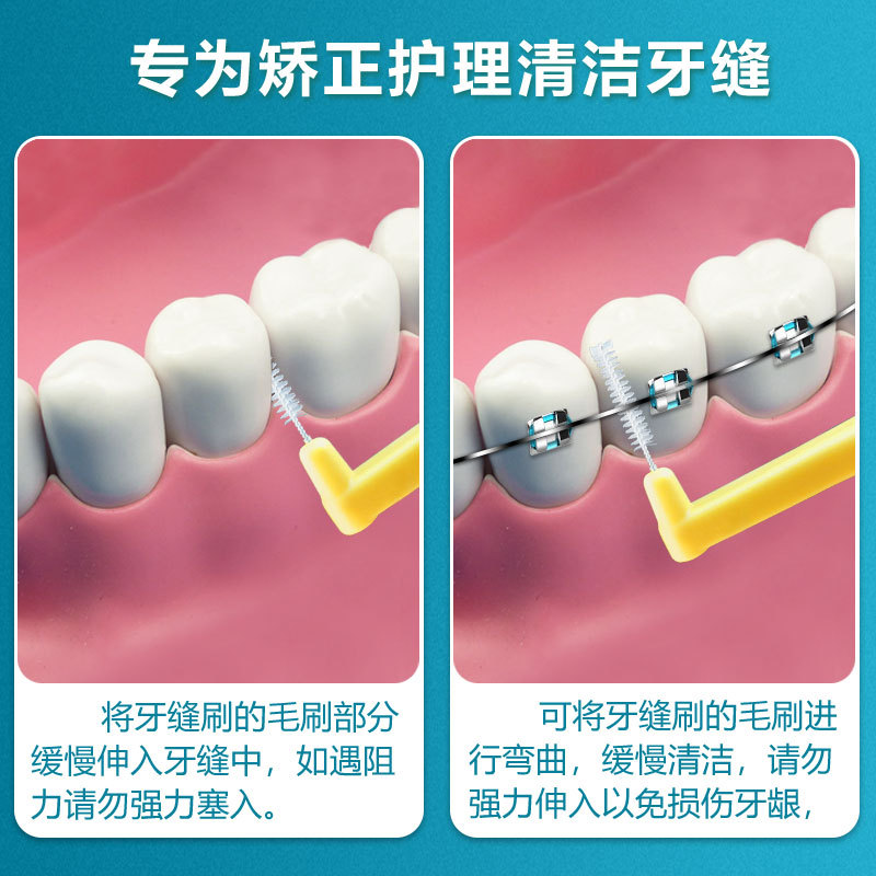 Cepillo Interdental en Forma de L 0,7 mm Set de 20 Limpieza para Cuidado Bucal