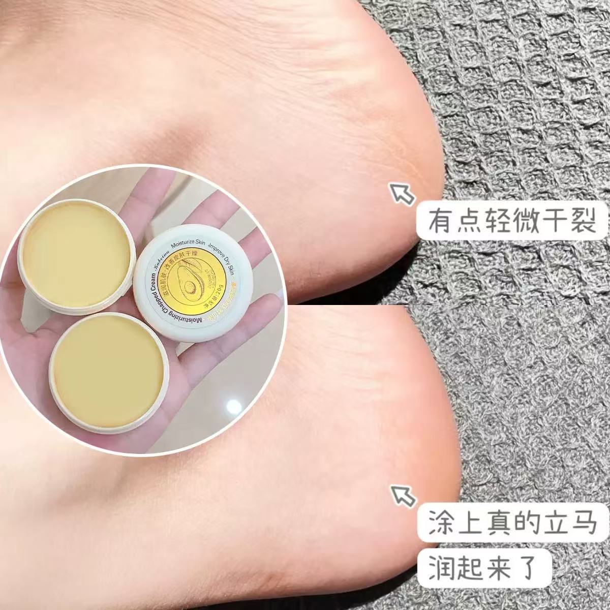 滋润草本皴裂膏护手霜足霜冻裂霜防裂膏20g