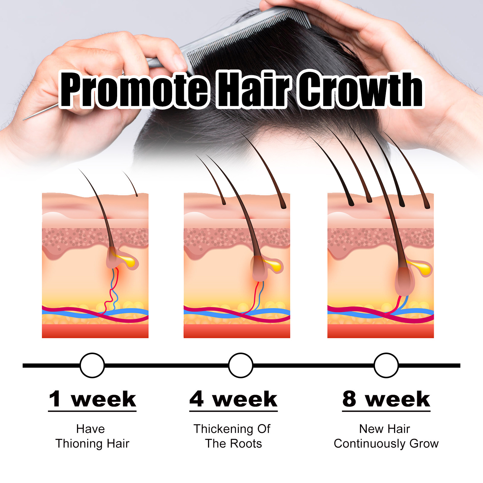 Cheveux denses OUHOE Répare les cheveux secs et doux, soin de massage du cuir chevelu, essence de cheveux denses_voghion.com