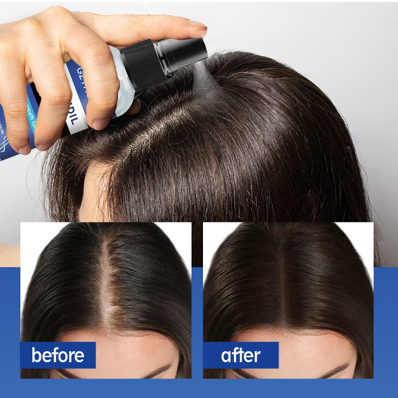 跨境5%米诺地亇儿酊溶液激活毛囊 头发再生密发液Hair Growth oil|undefined
