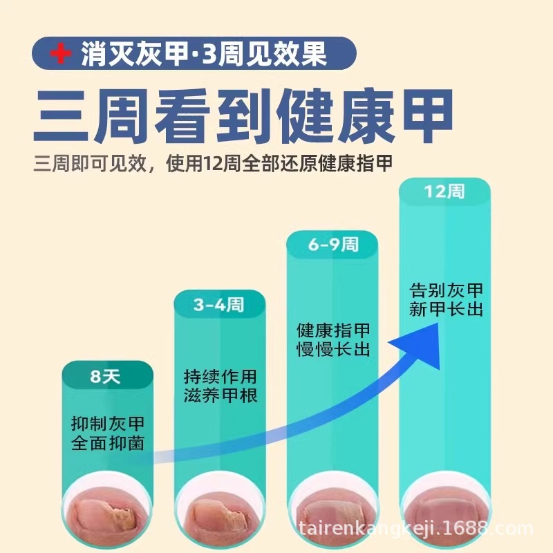Máquina de fototerapia de uñas grises domésticas esterilizantes ultravioletas lámpara láser de hongos herramientas de cuidado de uñas para el tratamiento JJ
