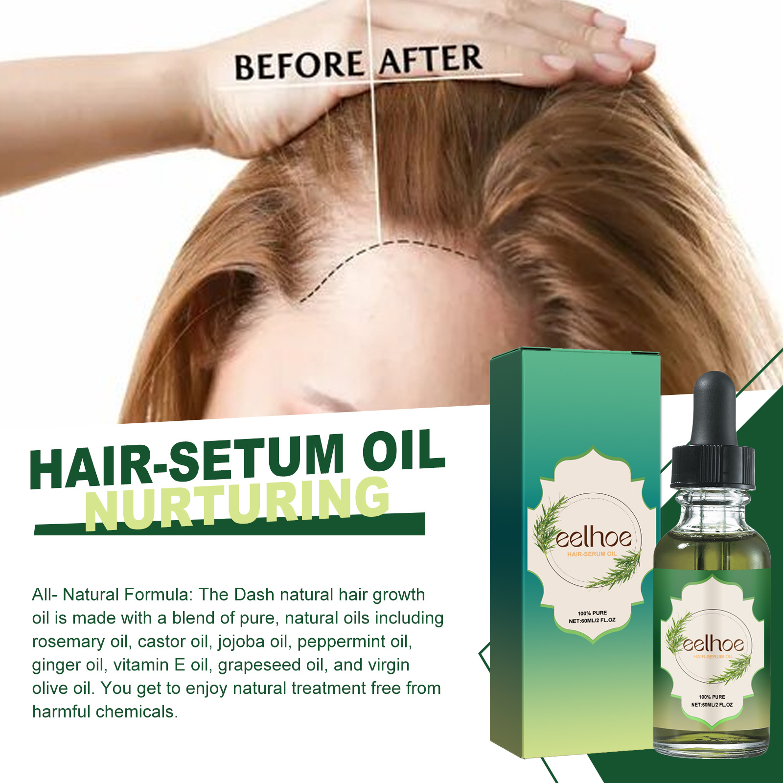 Das ätherische Rosmarin-Haaröl von EELHOE pflegt die Kopfhaut, beugt Haarausfall vor, verdichtet, spendet Feuchtigkeit und stärkt die Haarpflege_voghion.com