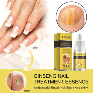 EELHOE �˅�ָ�׾��� �����������o�I�B����ȥܛ�׻�ָ�����o���A