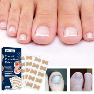 Cross-Border New Product Eelhoe Toenail Stickers Manicure and Nail Patches Hand and Foot Nail Cleaning 50Pcs