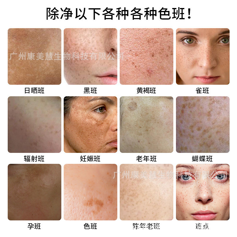 冷淡な肌が白くなった神器男女は1本の白1滴の白すっぴんクリームを拭きます。|undefined