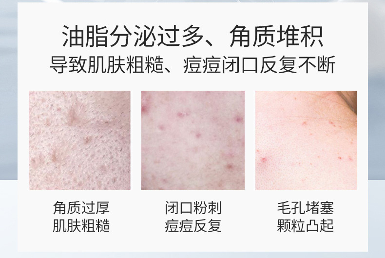 杏仁酸精华液_02.jpg