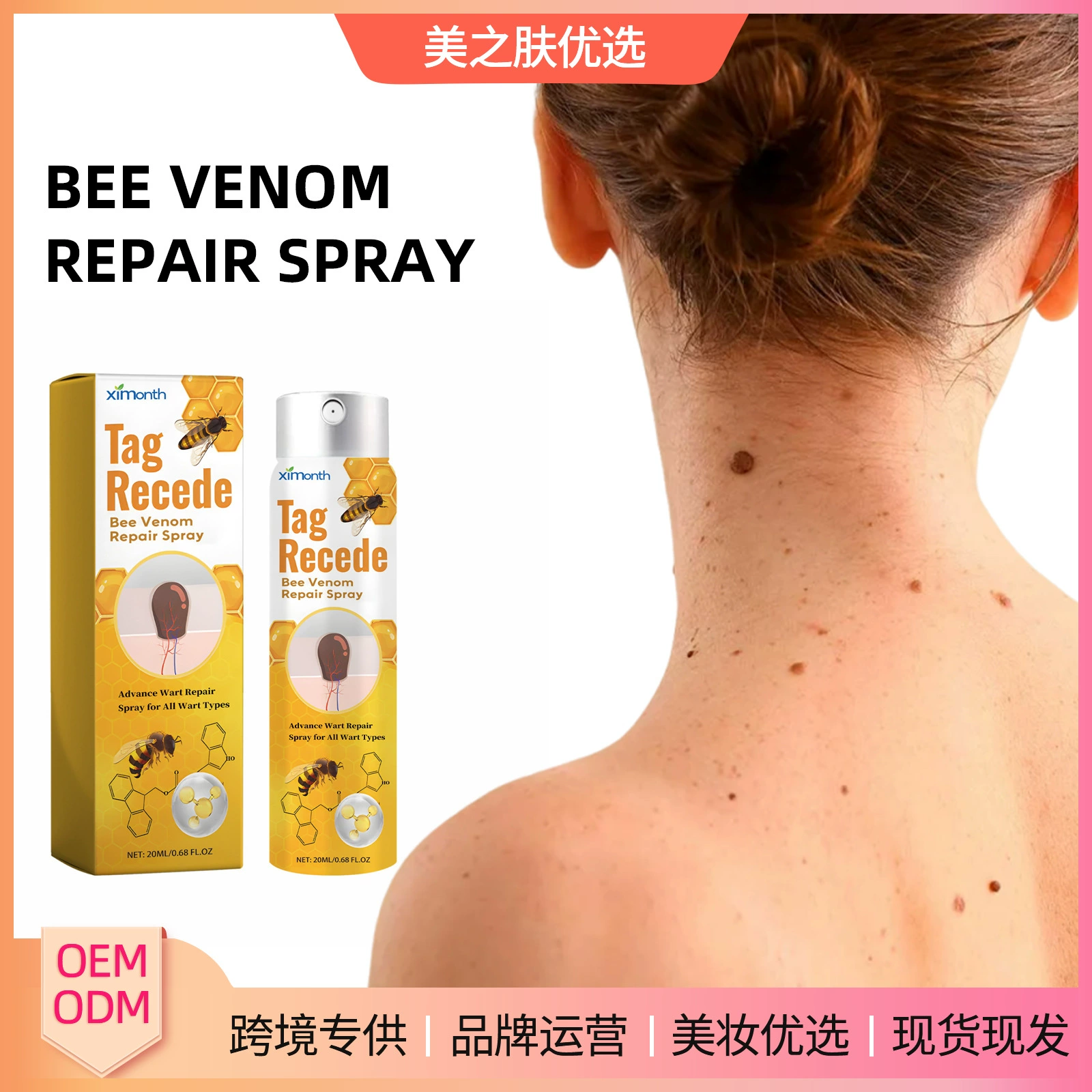 Спрей для удаления бородавок XIMONTH с пчелиным ядом: улучшает цвет кожи, разглаживает кожу, устраняет родинки и бородавки