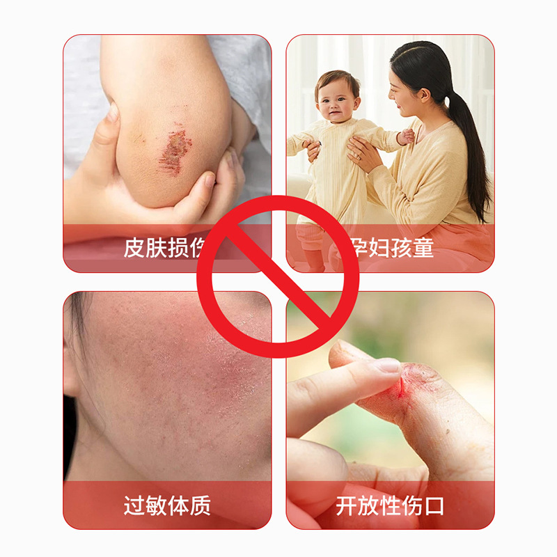 ニキビケア軟膏、湿毒清軟膏、皮膚炎湿疹かゆみ止め外用クリーム、皮膚軟膏（承認済み）|undefined