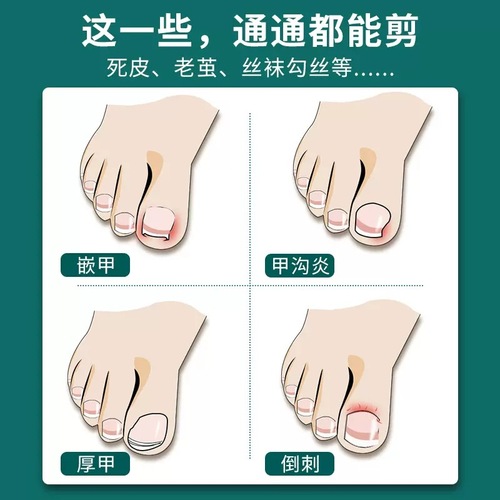 Oblique mouth nail clippers, nail scissors, oblique mouth nail groove special nail scissors, high-end pointed mouth, single small inflammatory nail clippers