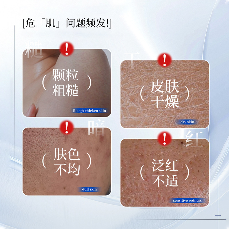 Suzhou ceramida asiatica rejuvenecimiento de la piel crema hidratante hidratación piel alivio reparador fabricante