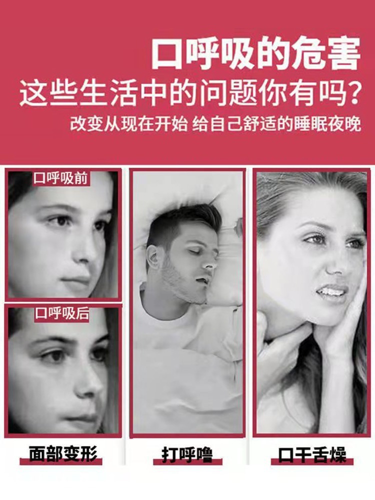 Mouth-breathing correction strap for correcting mouth breathing during sleep, adenoid hypertrophy facial appearance corrector, closed-mouth breathing training device