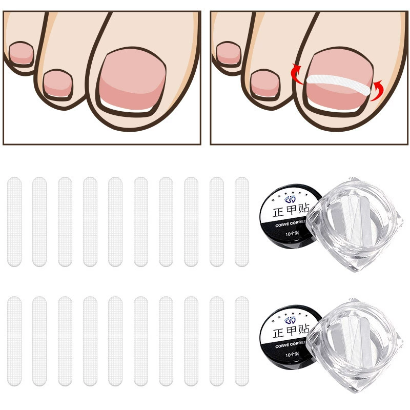 Ногтей ногтей патч для ногтей паз устройство для вставки ногтей патч для ногтей тянуть кусачки для ногтей плоскогубцы для ремонта ногтей ног