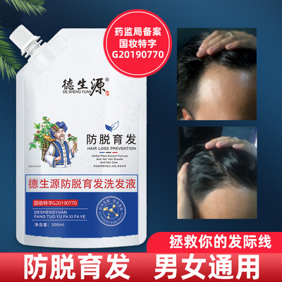 Anti-Hair Loss shampoo Additional issue Happen Oil control ginger shampoo Hairline factory machining OEM