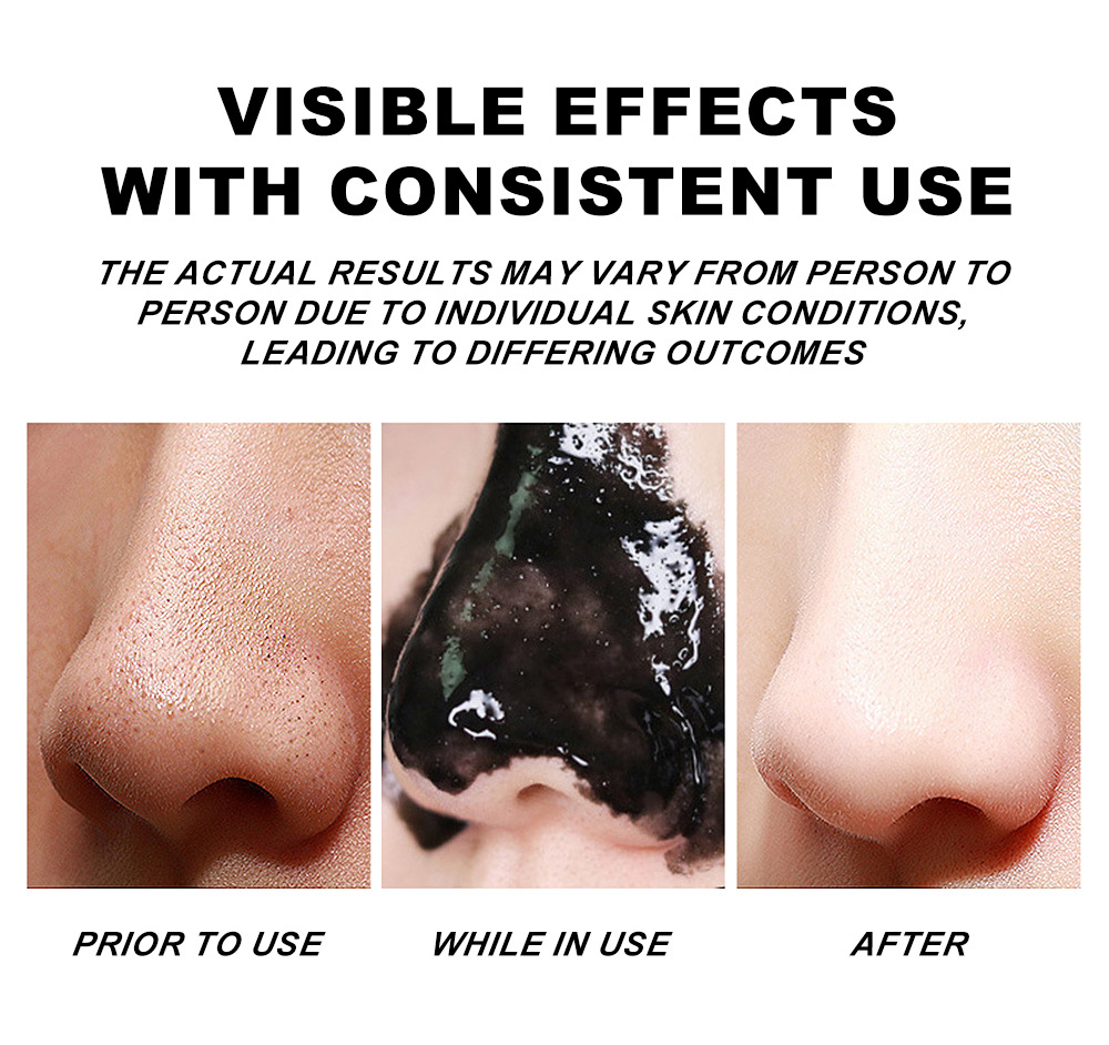 YOUNG VISION Nasal Mask 50g, peel-off Nasal Mask, Black Nasal mask undefined