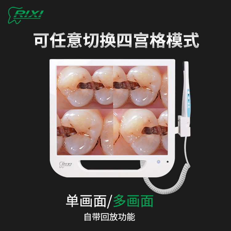 Endoscopio dental visual todo en uno Wifi cámara oral multimedia endoscopio dental de alta definición