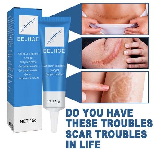 EELHOE Scar Repair Gel External Cold Compress Cream Skin Damage Repair Type Softens, Smoothes and Moisturizes Scars