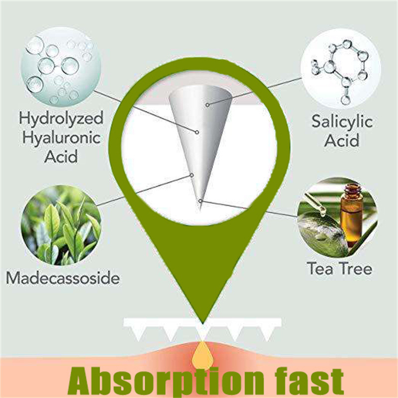 Title 2, Hyaluronsäure-Mikronadel-Akne-Patch