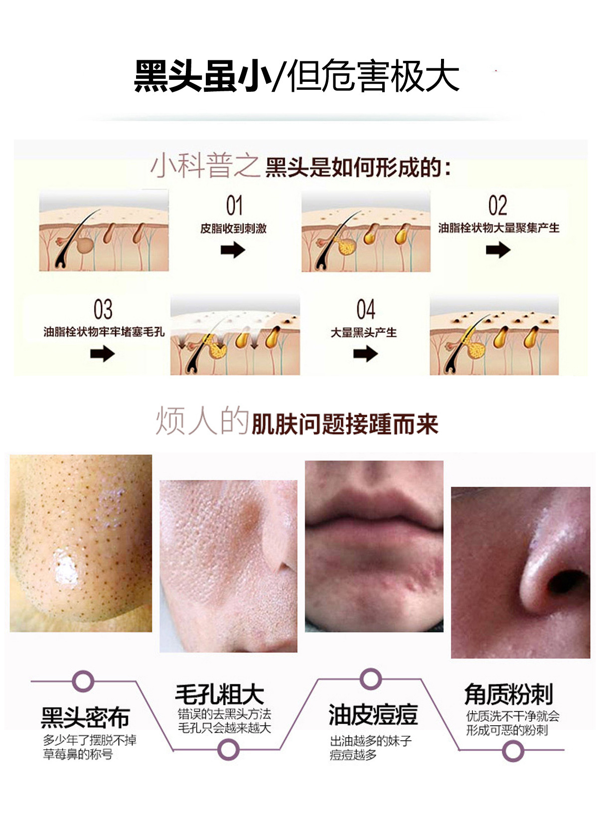 奥皮特EMS吸黑头仪器 微晶磨皮焕肤仪 面部微雕美容粉刺毛孔