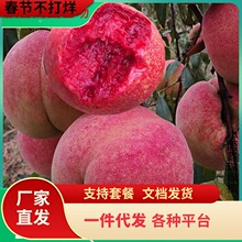 һ�����l�޽����Ә��m����Ѫ�Ҙ��m�ش�t��Ѫ���m����Y���ϱ���