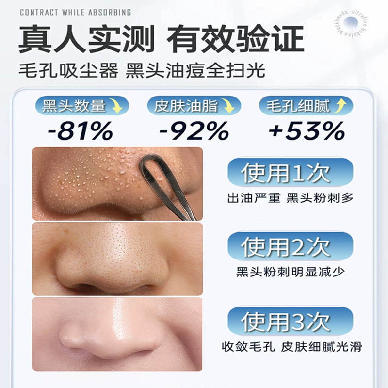 家用小氣泡注氧儀面部吸黑頭毛孔角質去粉刺潔面補水美白導入儀