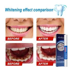 摩丝啫喱;润滑剂;牙齿美白笔