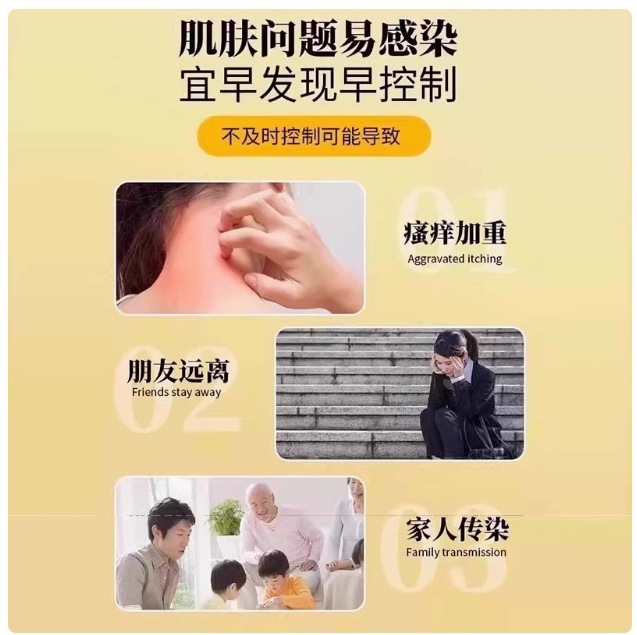 Sinopharm 漢方薬医療スキンケア軟膏在庫ありドロップシッピング公式正規価格優れた工場直送|undefined