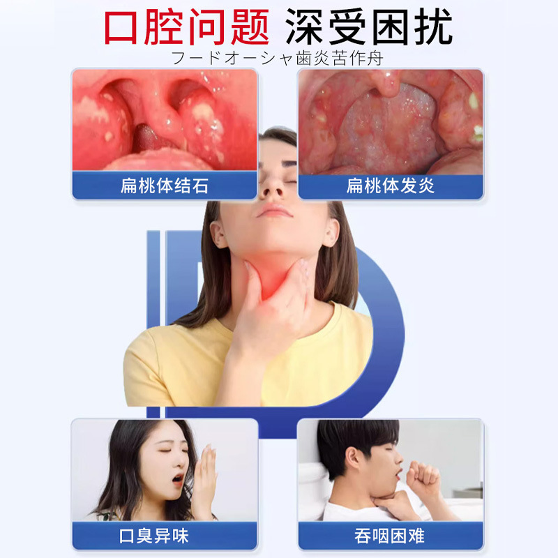 Jiuyan Pharmaceutical 口臭扁桃石除去ツール マウスウォッシュ スプレー クリーニング 口腔洗浄 隠れ巣洗浄|undefined