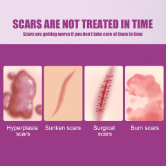 OUHOE 撫平傷疤修護膏 修護創傷皮膚淡化傷疤手術疤撫平肌膚修護