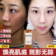 �ܹ���ԭҺ����Һȥ������S�ְߵ�ȸ�ߕ���ܰ�Һ���۰׾��AҺ��