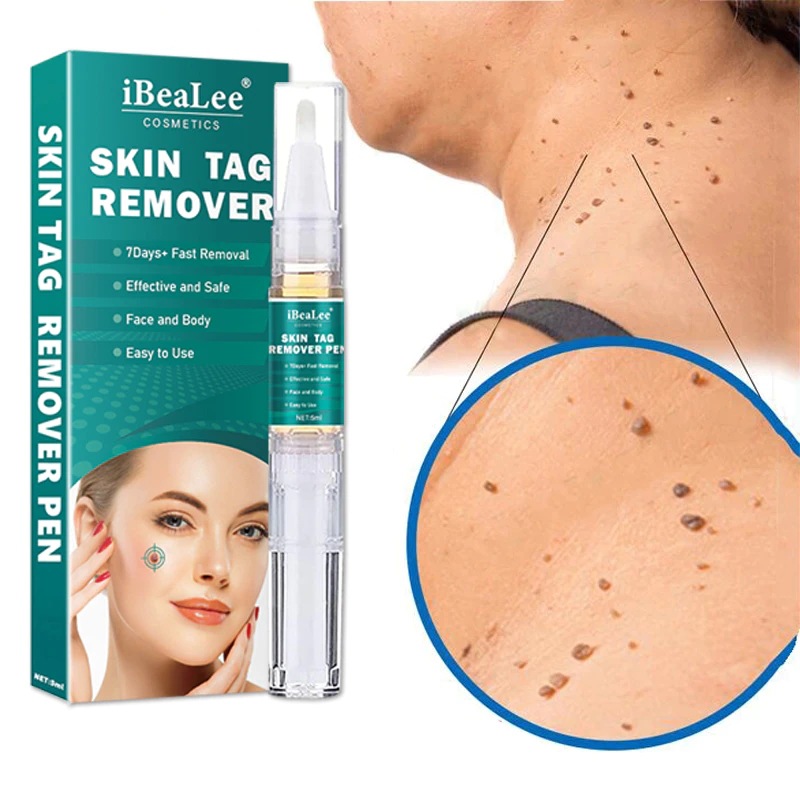 Stift für IBeaLee zum Entfernen flacher, besonders scharfer Warzen, Entfernerflüssigkeit, Creme und Warzenausgleichsflüssigkeit_voghion.com