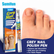 sumifun����ѷ�羳ָ���޻���ȥָ�׻�ָ�׻��������޻��� V50011