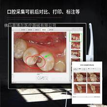 牙科内窥镜一体机1800万高清牙齿口腔镜17寸数字化电脑一体机