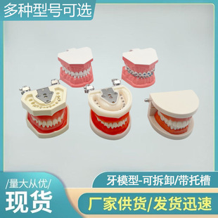 Oral Dental Tooth Model, Tooth Preparation Practice Soft Gum Tooth Model, Removable and Replaceable Artificial Resin Detached Tooth