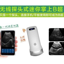 掌上B超凸阵腹部系列无线B超机探头 医用黑白B超 便携式彩色超声